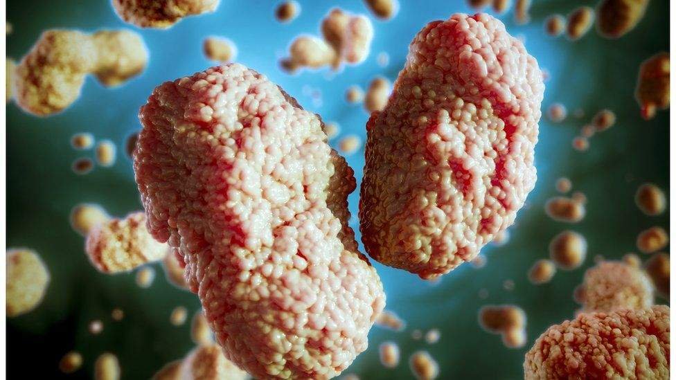 microscopic image of monkeypox virus Mpox virus